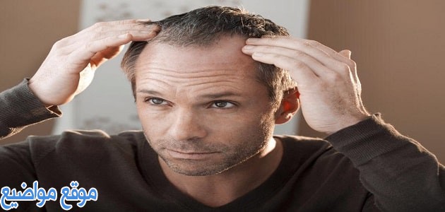 علاج الشعر الخفيف والمتساقط والمتقصف