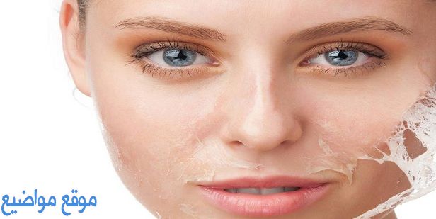 علاج المسامات الواسعة في الوجه والجسم طبيا